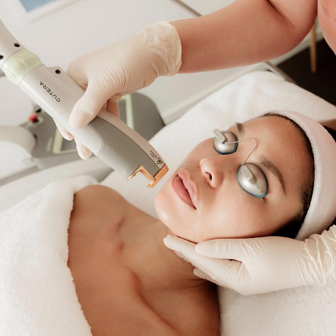 Cutera Laser Hair Removal About Face Medical Aesthetics Cutera Laser Hair Removal About Face Medical Aesthetics
